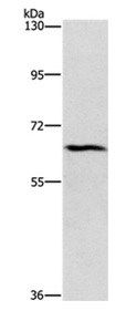 Western blot - Anti-CERKL antibody (AB198918)