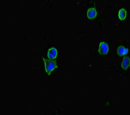 Immunocytochemistry/ Immunofluorescence - Anti-CERKL antibody (AB222828), expandable thumbnail