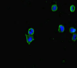 Immunocytochemistry/ Immunofluorescence - Anti-CERKL antibody (AB222828)