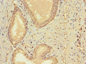 Immunohistochemistry (Formalin/PFA-fixed paraffin-embedded sections) - Anti-CERKL antibody (AB222828)