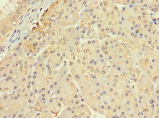 Immunohistochemistry (Formalin/PFA-fixed paraffin-embedded sections) - Anti-CERKL antibody (AB222828)