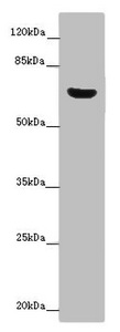 Western blot - Anti-CERKL antibody (AB222828), expandable thumbnail