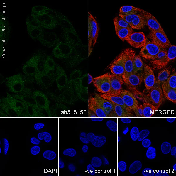 Immunocytochemistry/ Immunofluorescence - Anti-CerS2 antibody [EPR28098-1] (AB315452)