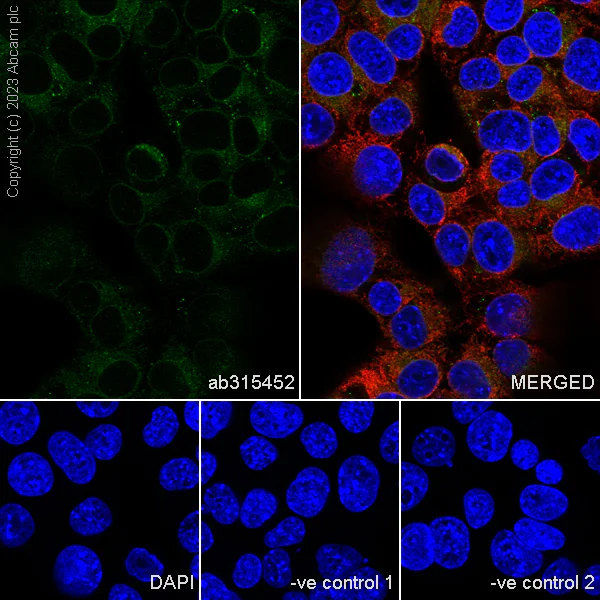 Immunocytochemistry/ Immunofluorescence - Anti-CerS2 antibody [EPR28098-1] (AB315452)