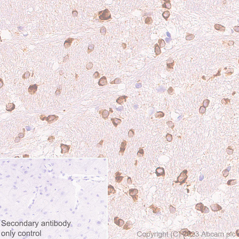 Immunohistochemistry (Formalin/PFA-fixed paraffin-embedded sections) - Anti-CerS2 antibody [EPR28098-1] (AB315452)