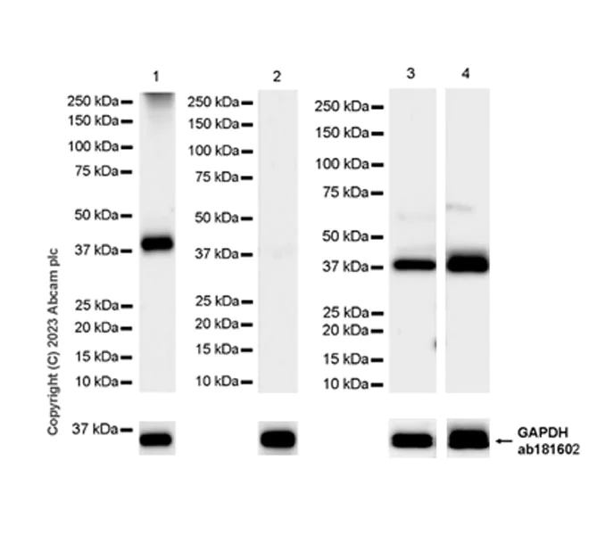 Western blot - Anti-CerS2 antibody [EPR28098-1] (AB315452)