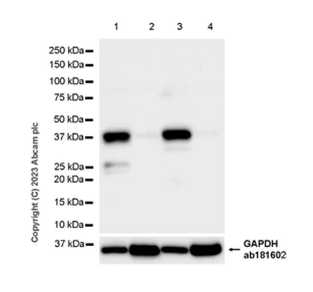 Western blot - Anti-CerS2 antibody [EPR28098-1] (AB315452)