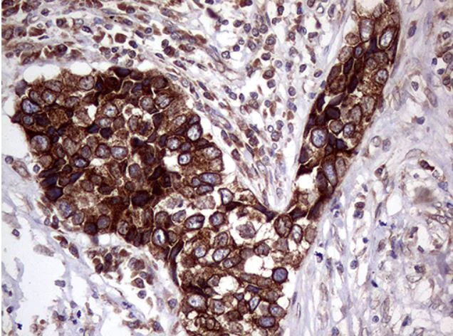 Immunohistochemistry (Formalin/PFA-fixed paraffin-embedded sections) - Anti-CerS2 antibody [OTI3D9] (AB279372)