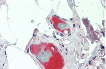 Immunohistochemistry (Formalin/PFA-fixed paraffin-embedded sections) - Anti-Ceruloplasmin antibody [C1] (AB239530)