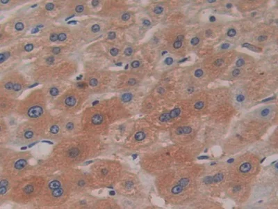 Immunohistochemistry (Formalin/PFA-fixed paraffin-embedded sections) - Anti-Ceruloplasmin antibody [C1] (AB239530)