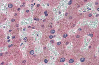 Immunohistochemistry (Formalin/PFA-fixed paraffin-embedded sections) - Anti-Ceruloplasmin antibody [C1] (AB239530)