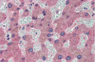 Immunohistochemistry (Formalin/PFA-fixed paraffin-embedded sections) - Anti-Ceruloplasmin antibody [C1] (AB239530)