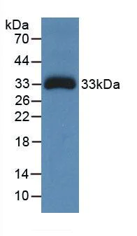 Western blot - Anti-Ceruloplasmin antibody [C1] (AB239530)