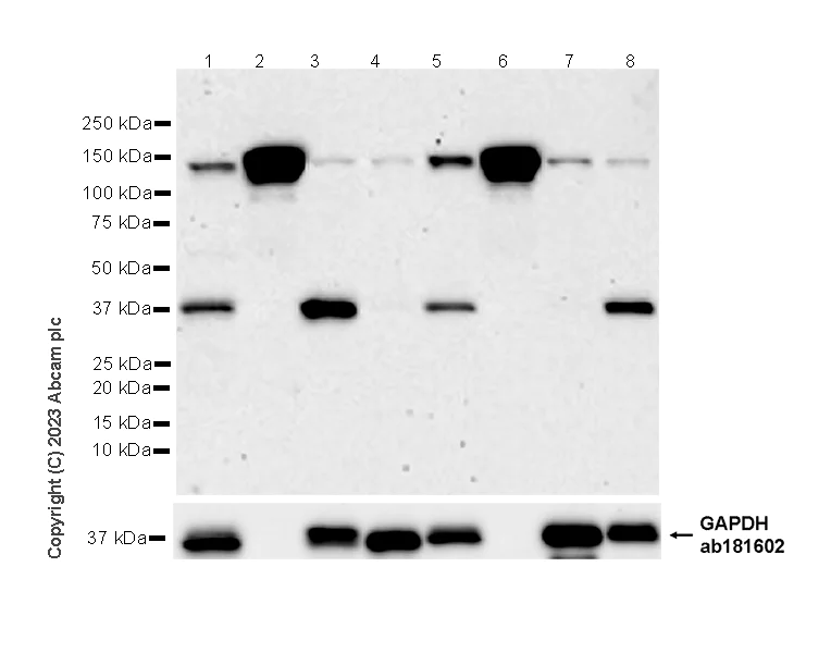 Western blot - Anti-Ceruloplasmin antibody [EPR28432-1] (AB314668)