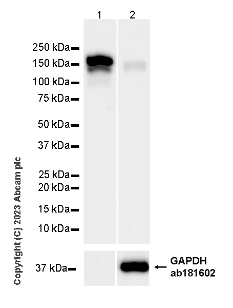 Western blot - Anti-Ceruloplasmin antibody [EPR28432-1] (AB314668)