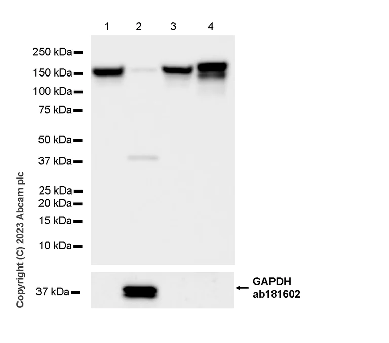 Western blot - Anti-Ceruloplasmin antibody [EPR28432-1] - BSA and Azide free (AB314669)