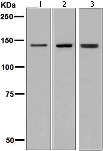 Western blot - Anti-Ceruloplasmin antibody [EPSISR6-12] (AB131220)