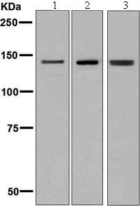 Western blot - Anti-Ceruloplasmin antibody [EPSISR6-12] - BSA and Azide free (AB232055)
