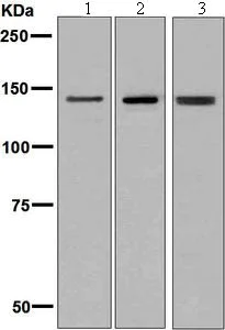 Western blot - Anti-Ceruloplasmin antibody [EPSISR6-12] - BSA and Azide free (AB232055)