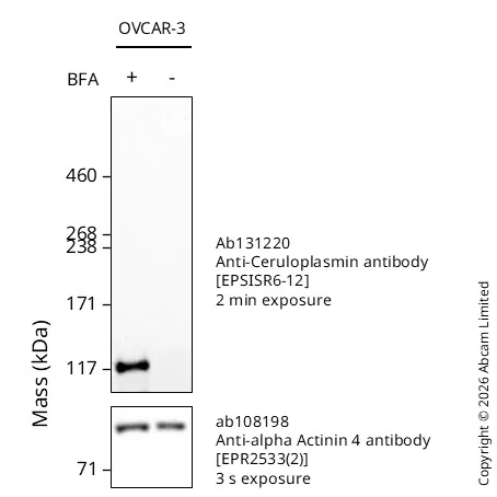 Western blot - Anti-Ceruloplasmin antibody [EPSISR6-12] - BSA and Azide free (AB232055)