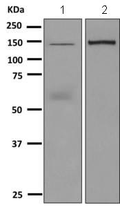Western blot - Anti-Ceruloplasmin antibody [EPSISR6-42] (AB157452)