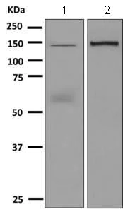 Western blot - Anti-Ceruloplasmin antibody [EPSISR6-42] (AB157452)