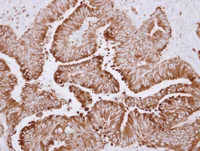 Immunohistochemistry (Formalin/PFA-fixed paraffin-embedded sections) - Anti-CES2 antibody (AB126970)