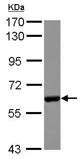 Western blot - Anti-CES2 antibody (AB126970)