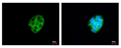 Immunocytochemistry/ Immunofluorescence - Anti-CES2 antibody (AB137606)