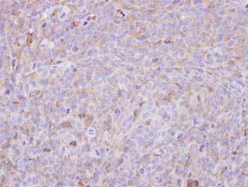 Immunohistochemistry (Formalin/PFA-fixed paraffin-embedded sections) - Anti-CES2 antibody (AB137606)