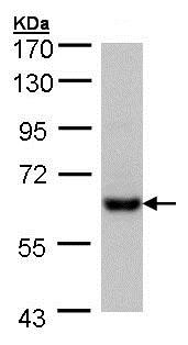 Western blot - Anti-CES2 antibody (AB137606)
