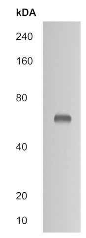 Western blot - Anti-CES2 antibody (AB215042)