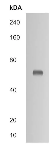 Western blot - Anti-CES2 antibody (AB215042)