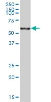 Western blot - Anti-CES2 antibody (AB88439)