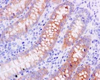 Immunohistochemistry (Formalin/PFA-fixed paraffin-embedded sections) - Anti-CES2 antibody [EPR14856] (AB184957)