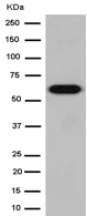 Western blot - Anti-CES2 antibody [EPR14856] (AB184957)