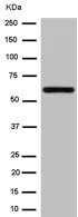 Western blot - Anti-CES2 antibody [EPR14856] (AB184957)