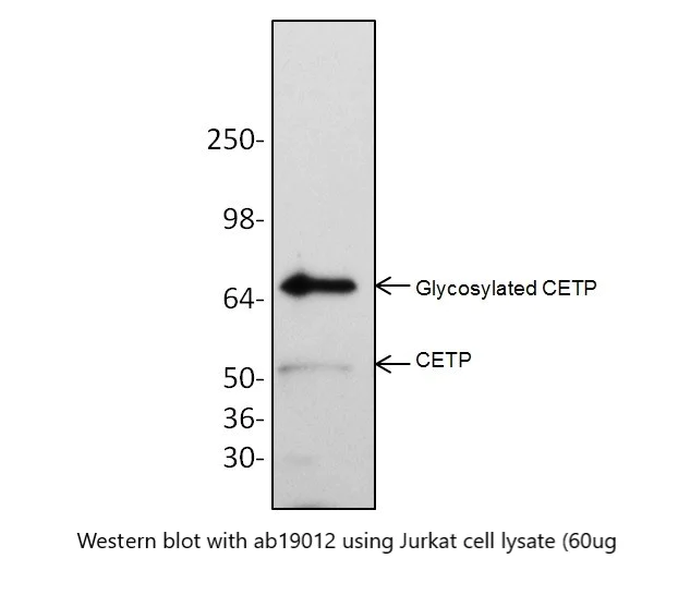 Western blot - Anti-CETP antibody (AB19012)