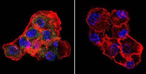 Immunocytochemistry/ Immunofluorescence - Anti-CETP antibody [ATM192] (AB2726)
