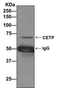 Immunoprecipitation - Anti-CETP antibody [EPR13] - BSA and Azide free (AB249291), expandable thumbnail