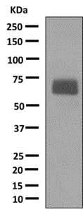 Western blot - Anti-CETP antibody [EPR13] - BSA and Azide free (AB249291)