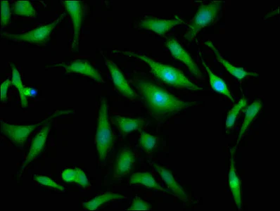 Immunocytochemistry/ Immunofluorescence - Anti-Cezanne antibody (AB238678)