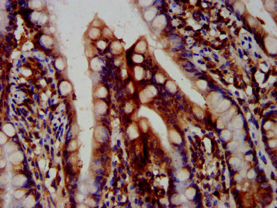 Immunohistochemistry (Formalin/PFA-fixed paraffin-embedded sections) - Anti-Cezanne antibody (AB238678)