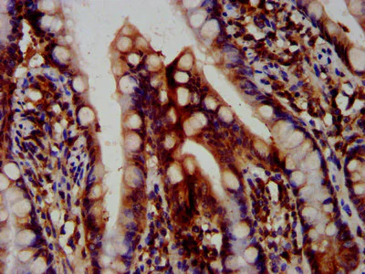 Immunohistochemistry (Formalin/PFA-fixed paraffin-embedded sections) - Anti-Cezanne antibody (AB238678)