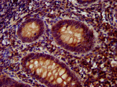 Immunohistochemistry (Formalin/PFA-fixed paraffin-embedded sections) - Anti-Cezanne antibody (AB238678)