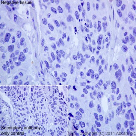 Immunohistochemistry (Formalin/PFA-fixed paraffin-embedded sections) - Anti-CFH + CFHL1 antibody [EPR17159] (AB200656), expandable thumbnail