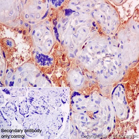 Immunohistochemistry (Formalin/PFA-fixed paraffin-embedded sections) - Anti-CFH + CFHL1 antibody [EPR17159] (AB200656), expandable thumbnail