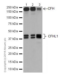 Western blot - Anti-CFH + CFHL1 antibody [EPR17159] (AB200656), expandable thumbnail