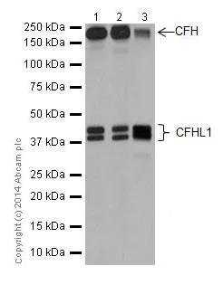 Western blot - Anti-CFH + CFHL1 antibody [EPR17159] (AB200656)