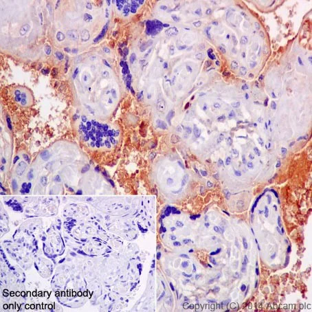 Immunohistochemistry (Formalin/PFA-fixed paraffin-embedded sections) - Anti-CFH + CFHL1 antibody [EPR17159] - BSA and Azide free (AB251314)